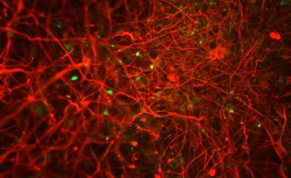 Red flourescence shows Alzheimer plaques in human stem cell derived neurons